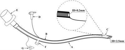 Safety and efficacy of a novel double-lumen tracheal tube in neonates with RDS: A prospective cohort study